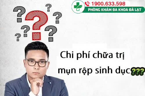 Hình ảnh minh họa